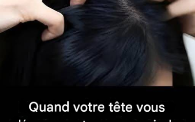 Vous avez la tête qui démange ? Voici les principales causes.
