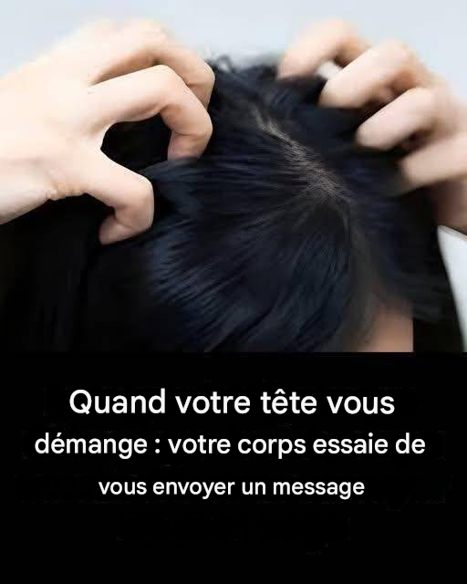 Vous avez la tête qui démange ? Voici les principales causes.