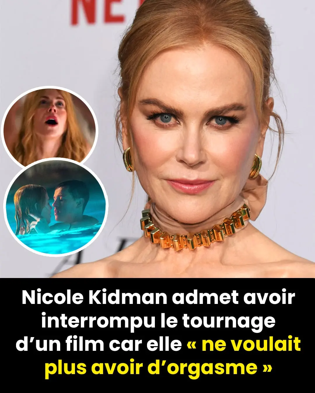 Nicole Kidman poussée à suspendre le tournage de son dernier projet cinématographique
