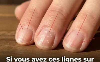 Stries verticales sur les ongles : pourquoi apparaissent-elles plus fréquemment avec l’âge ?