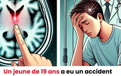 Un cas rare : Un adolescent de 19 ans victime d’un AVC suite à des maux de tête