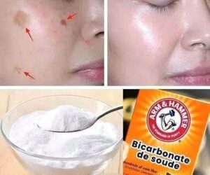 4 astuces pour estomper les taches de vieillesse avec du bicarbonate de soude et obtenir une peau plus jeune et plus uniforme