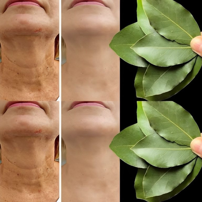 Est-ce que 100 000 $ ont été dépensés simplement pour le Botox? | En nature, kur mod rynker, seulement 70 ans !