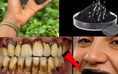 Comment soigner naturellement une carie et renforcer vos dents au quotidien
