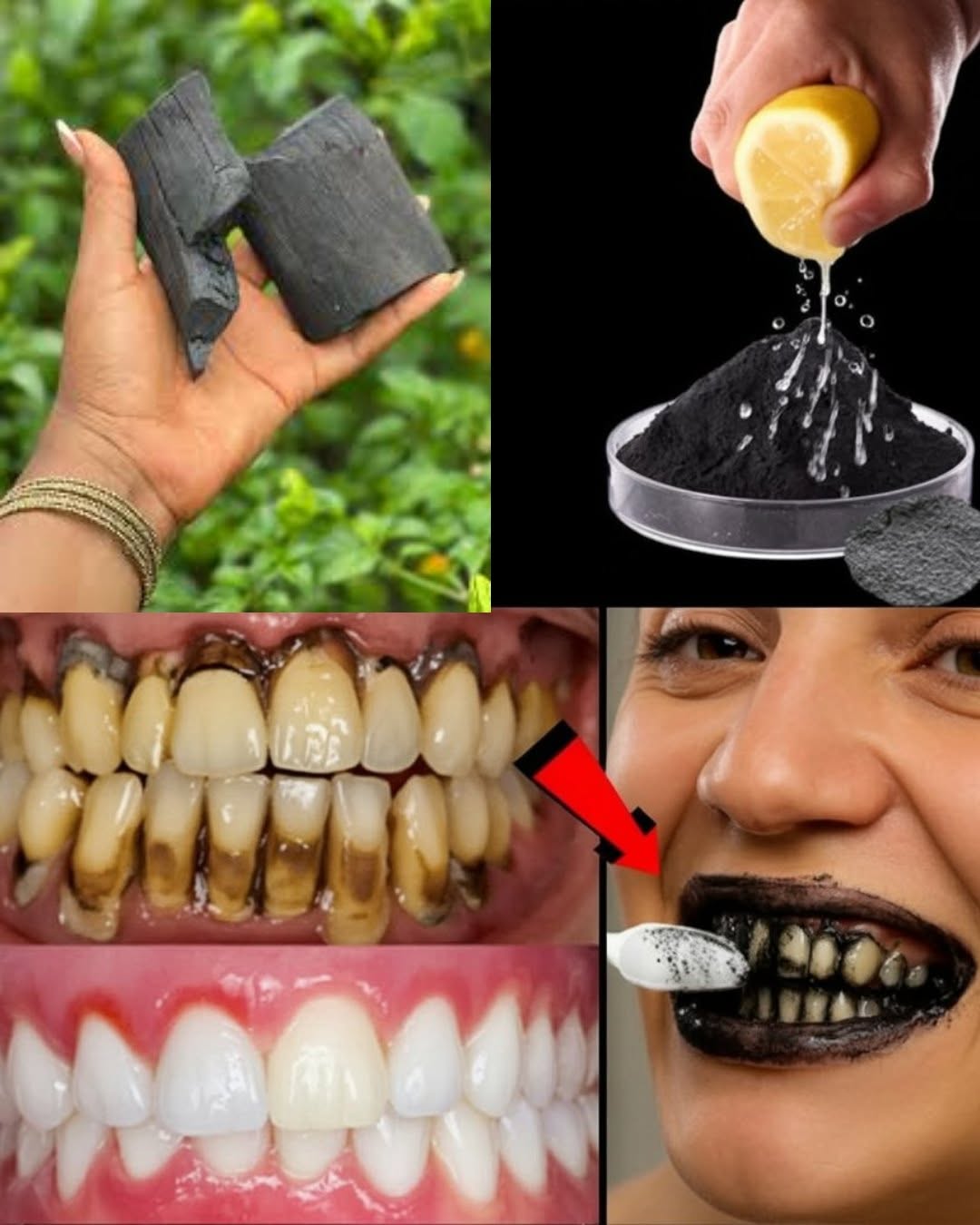 Comment soigner naturellement une carie et renforcer vos dents au quotidien