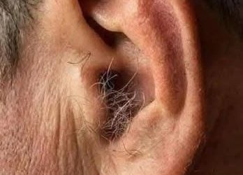 LE SAVIEZ-VOUS ? Si des poils poussent sur vos oreilles, c’est parce que votre corps…