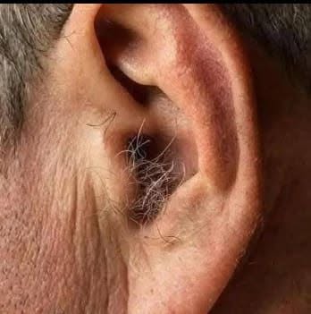 LE SAVIEZ-VOUS ? Si des poils poussent sur vos oreilles, c’est parce que votre corps…