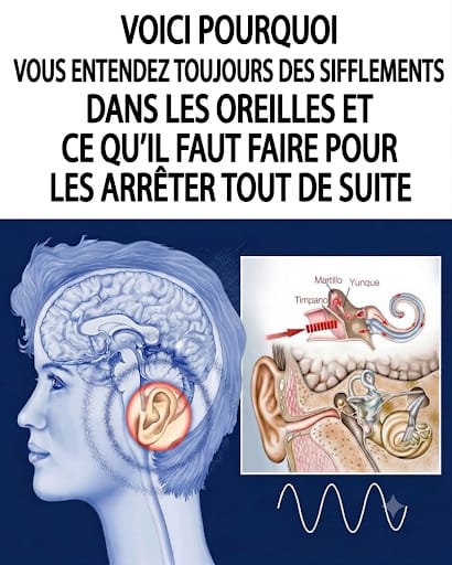 Bourdonnements d’oreilles : pourquoi et comment s’en débarrasser