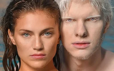 À quoi ressemble le fils du plus bel albinos et d’un mannequin ? Un enfant à la beauté exceptionnelle