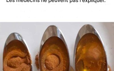 Cannelle et miel : le remède le plus efficace que même les médecins ne peuvent expliquer