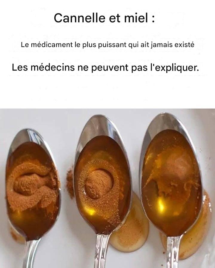 Cannelle et miel : le remède le plus efficace que même les médecins ne peuvent expliquer