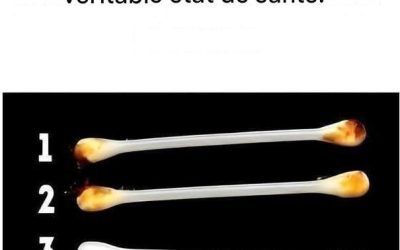 Nos oreilles révèlent notre véritable état de santé.