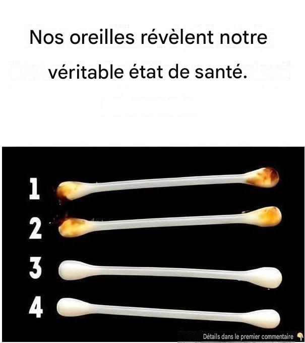Nos oreilles révèlent notre véritable état de santé.