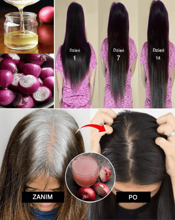 Défi hebdomadaire pour la pousse des cheveux : Remède à base d’oignon et de miel pour une pousse ultra-rapide