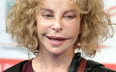 Elle était autrefois la favorite de millions de personnes grâce à son apparence atypique, mais elle a radicalement changé à cause de la chirurgie esthétique