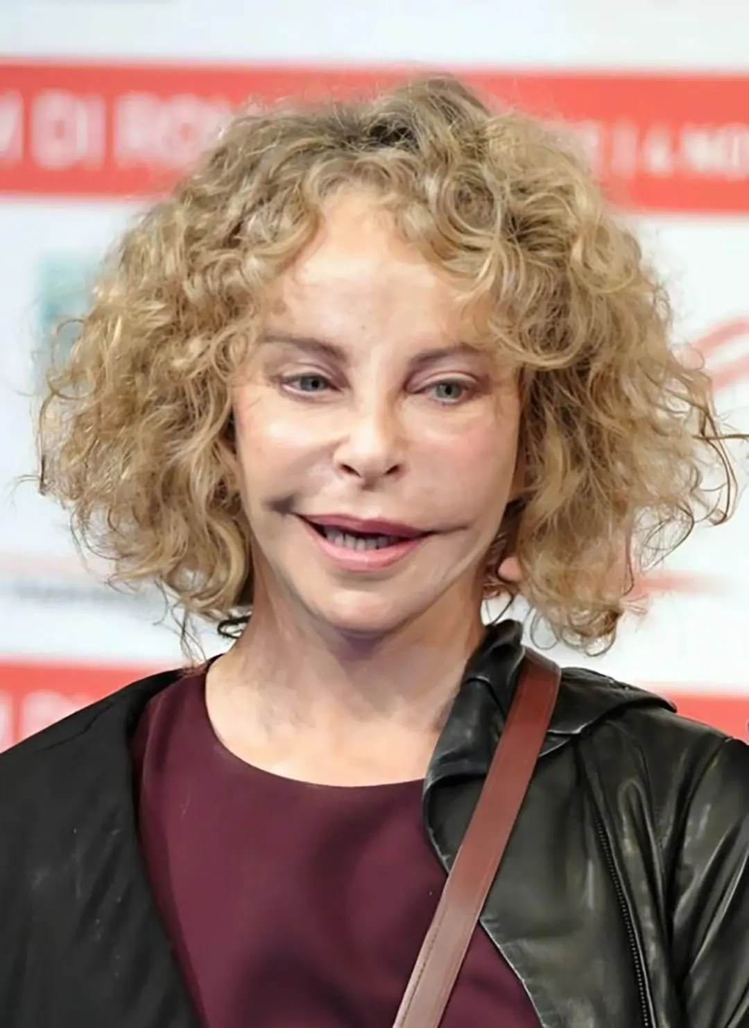 Elle était autrefois la favorite de millions de personnes grâce à son apparence atypique, mais elle a radicalement changé à cause de la chirurgie esthétique
