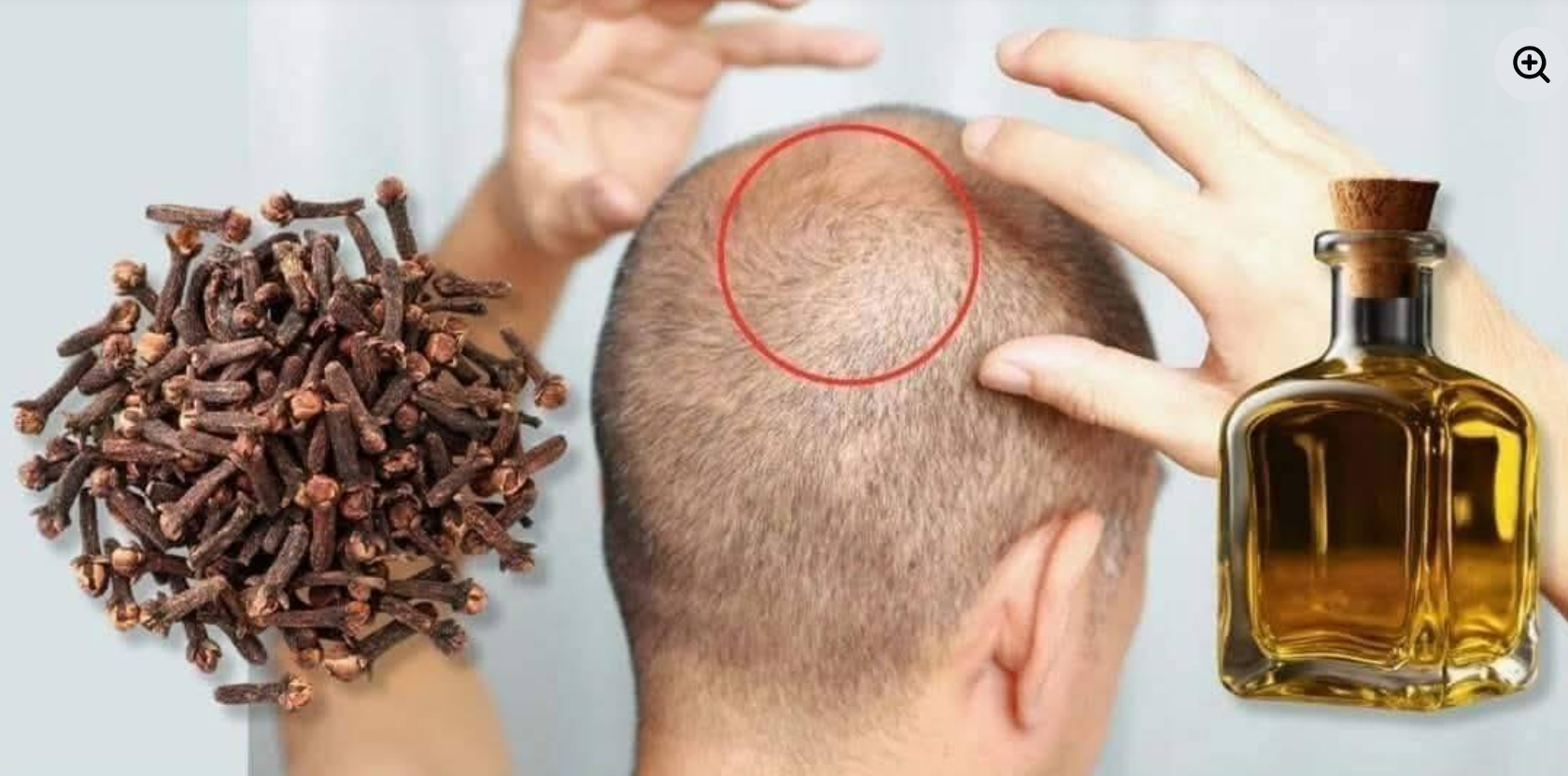 À 75 ans, les cheveux repoussent même sur les zones dégarnies ! Voici comment l’huile de clou de girofle peut stimuler la pousse des cheveux.