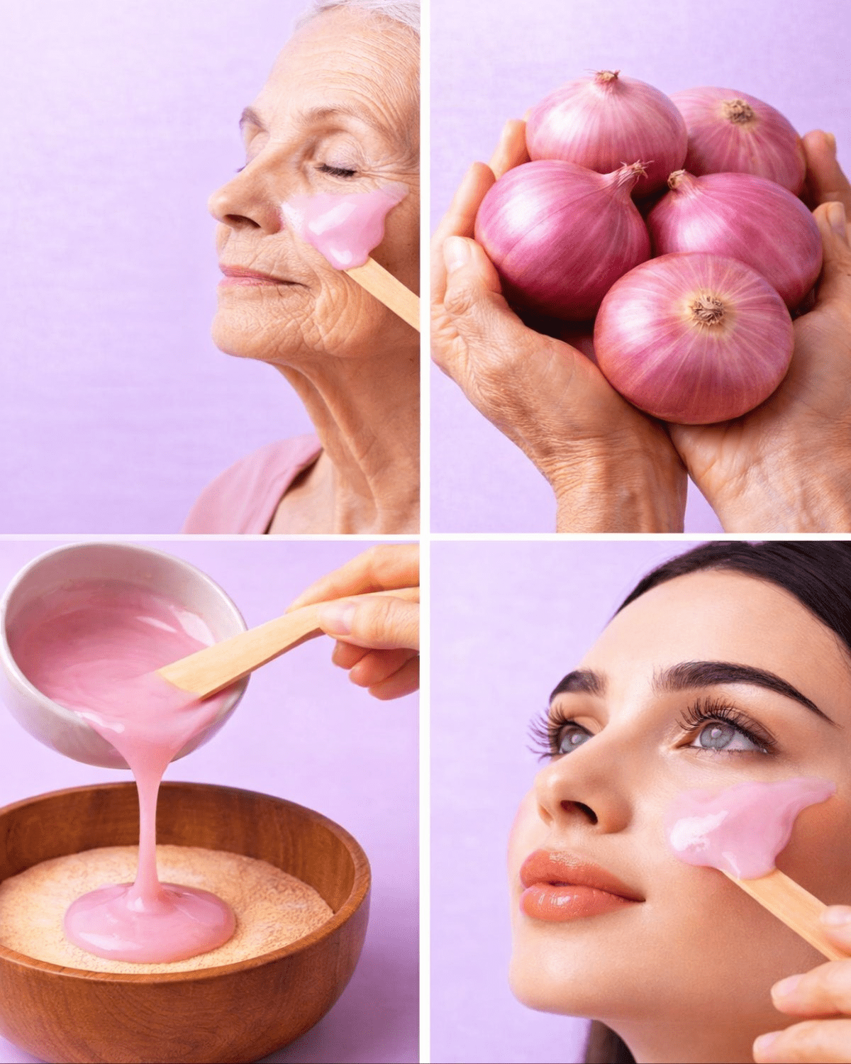 Vous est-il déjà arrivé de vous regarder dans le miroir et de rêver d’une peau éclatante sans maquillage ? Peut-être remarquez-vous des ridules, des taches brunes ou une pigmentation irrégulière que le maquillage ne parvient pas à camoufler complètement. Et si un ingrédient courant de votre cuisine pouvait vous aider à obtenir une peau plus lisse et plus radieuse naturellement ? Étonnamment, les oignons – oui, ceux-là mêmes que vous avez dans vos pancartes – contiennent des composés qui peuvent favoriser la santé de la peau et lui donner une apparence plus jeune.  Vous êtes peut-être sceptique. « Des oignons ? Pour le visage ? » Cela semble improbable, mais transformé en masque doux, les oignons libèrent des composés soufrés, des antioxydants et des vitamines qui nourrissent la peau. Découvrez pourquoi ce remède simple est plébiscité depuis des générations en cosmétique naturelle et comment il pourrait révolutionner votre routine beauté.  Pourquoi le vieillissement cutané et la pigmentation se suivent-ils ? Le vieillissement cutané est influencé par de nombreux facteurs : l’exposition au soleil, la pollution, l’alimentation et la diminution naturelle du cartilage et de l’élastine. Des taches brunes et une pigmentation apparaissent lorsque la mélanine est produite en excès dans certaines zones. Les ridules et les rides se forment lorsque la peau perd de son hydratation et de son élasticité.  Pour Margaret, 61 ans, ces changements étaient source de frustration. Chaque matin, elle appliquait plusieurs couches d’anticernes et de fond de teint, mais les cernes et les taches brunes autour de ses yeux et sur ses joues semblaient impossibles à camoufler. Le processus était pour elle une corvée. Elle recherche une solution respectueuse de sa peau, et non une solution agressive. C’est alors qu’elle a découvert le potentiel des soins à base d’oignon.