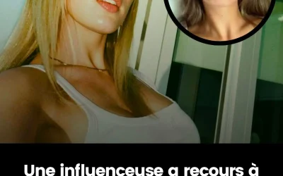 Une influenceuse affirme avoir subi une rhinoplastie dans l’idée que ses enfants puissent hériter de son nouveau nez
