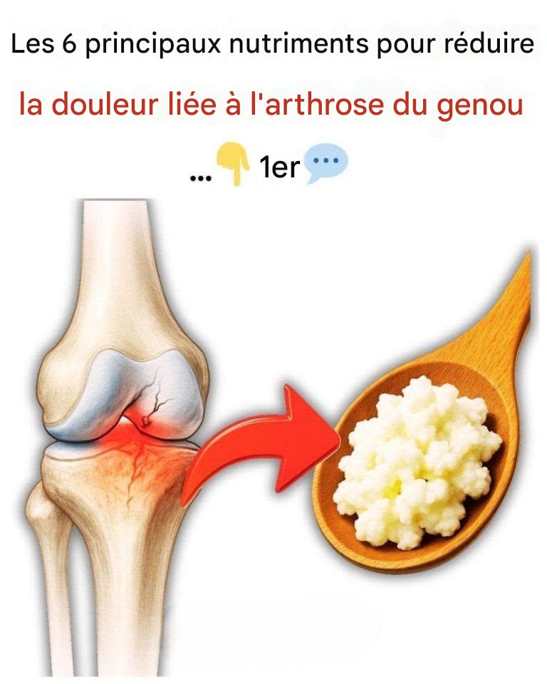 Les 6 principaux nutriments pour réduire la douleur liée à l’arthrose du genou