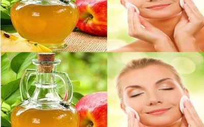 Pourquoi nettoyer votre visage avec du vinaigre de cidre